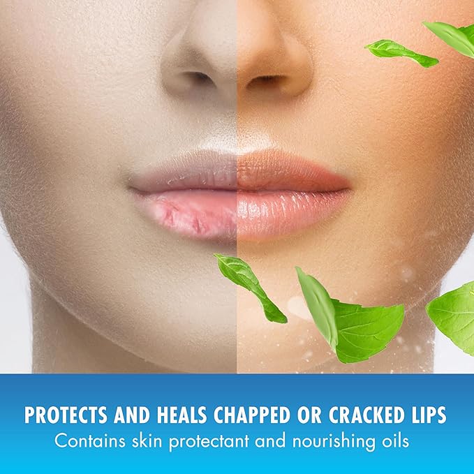 Mentholatum Natural Ice Original Medicated Lip Balm, Hydrating Lip Care for Dry, Chapped Lips, Moisturizing Formula with SPF 15 Helps Prevent Sunburn, Protection for Smooth, Soft Lips (Pack of 12)