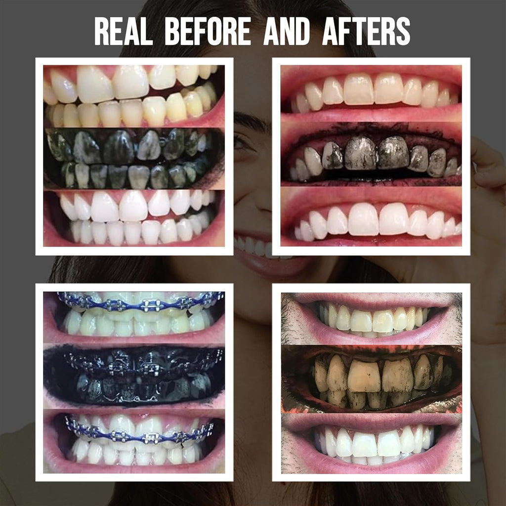 Premium Activated Charcoal Natural Coconut Teeth Whitening Powder - Safe for Enamel to get a Whiter and Brighter Smile - Organic Toothpaste Detoxifier
