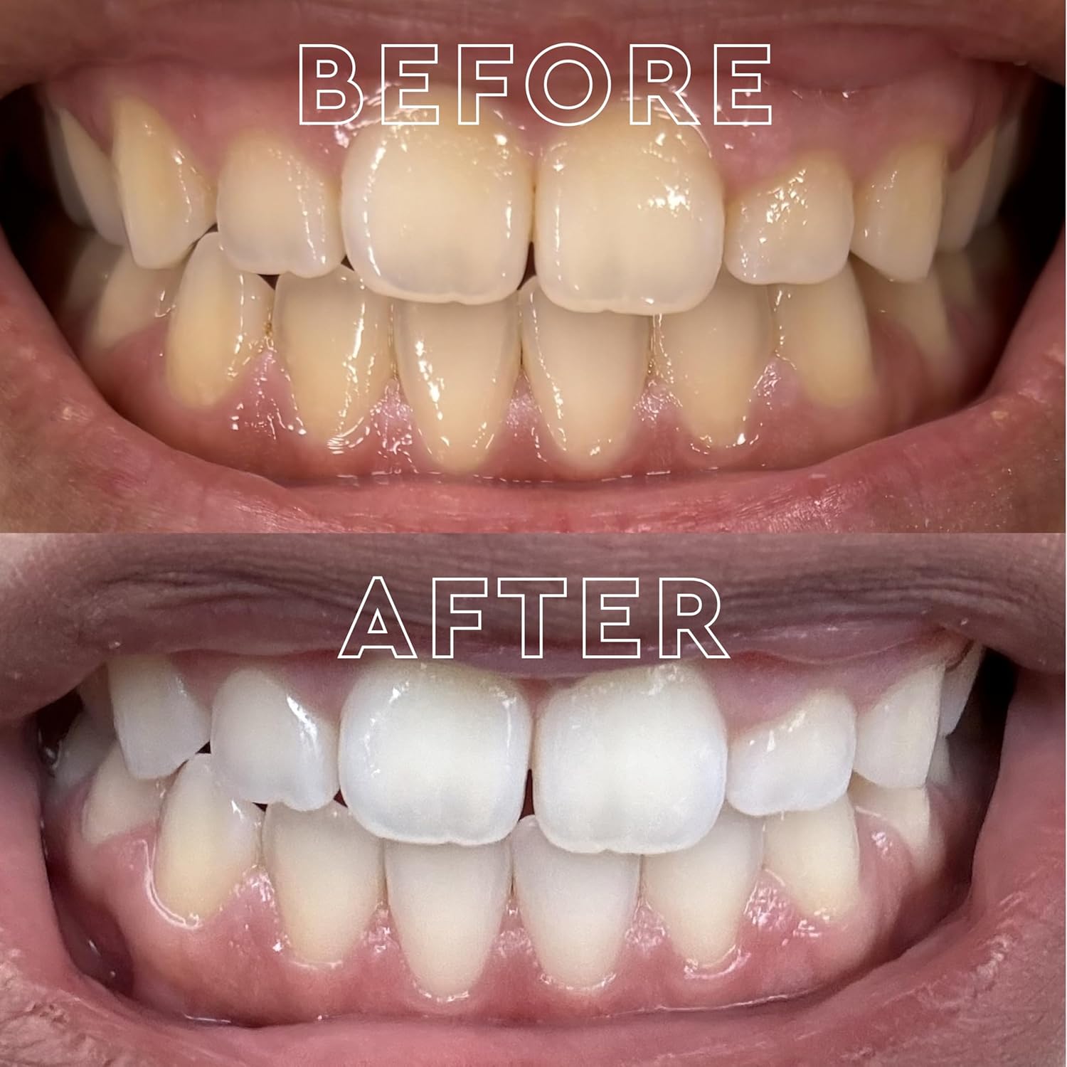 MOON Dissolving Teeth Whitening Strips, 28 Platinum Express No Rinse White Strips, Winter Mint, Hydrogen Peroxide & Essential Oils, Whiten Sensitive Teeth up to 8 Shades in 1 Week, Travel Essentials