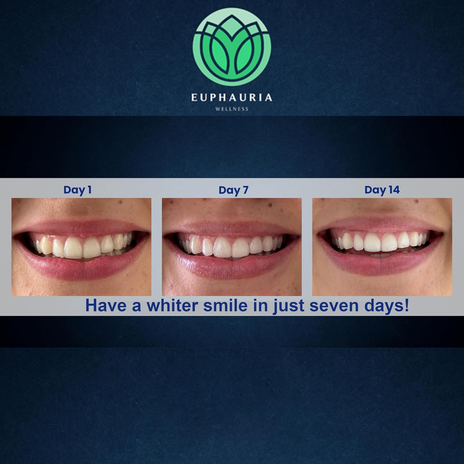 Premium Teeth Whitening Pen with Pro Whitening Gel 4ML (0.14fl oz) Professional Pen Solution with Hydrogen Peroxide Gel Refill for Teeth, Convenient & Travel-Friendly Stick Design for Adults