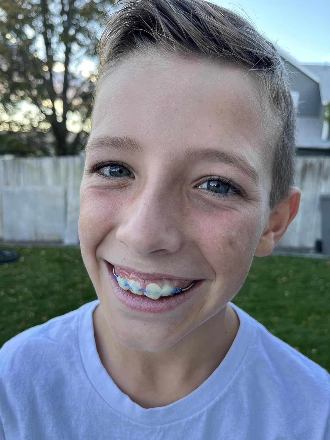 Orthodontic Wax – Original Honey, Natural Braces Protection, Long-Lasting Comfort, Pre-Cut Wax Pieces in Aluminum Travel Case (75 Buttons) - Fresh Mint