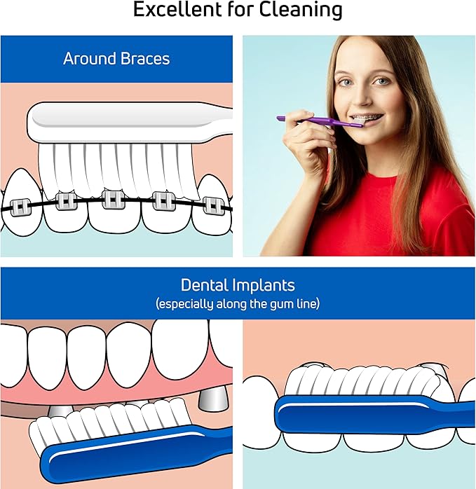 TePe Implant Orthodontic Soft Toothbrush – Extra Narrow Brush Head Thin Neck 1Pk