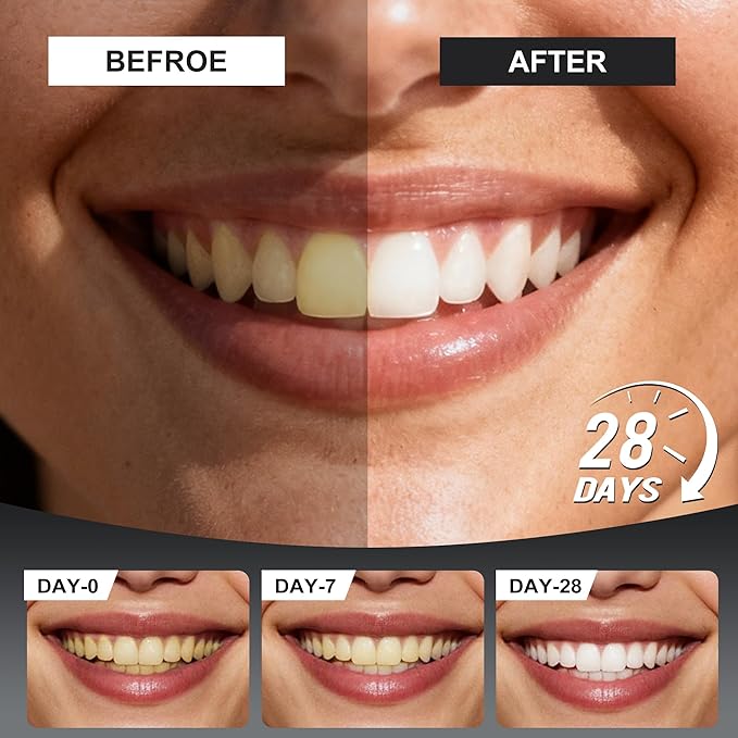 Woadee 7.5% Nano Hydroxyapatite Toothpaste Tablets - Remineralizing Enamel Repair, Fluoride-Free Whitening, Mint Fresh Travel Tabs (62 Count)