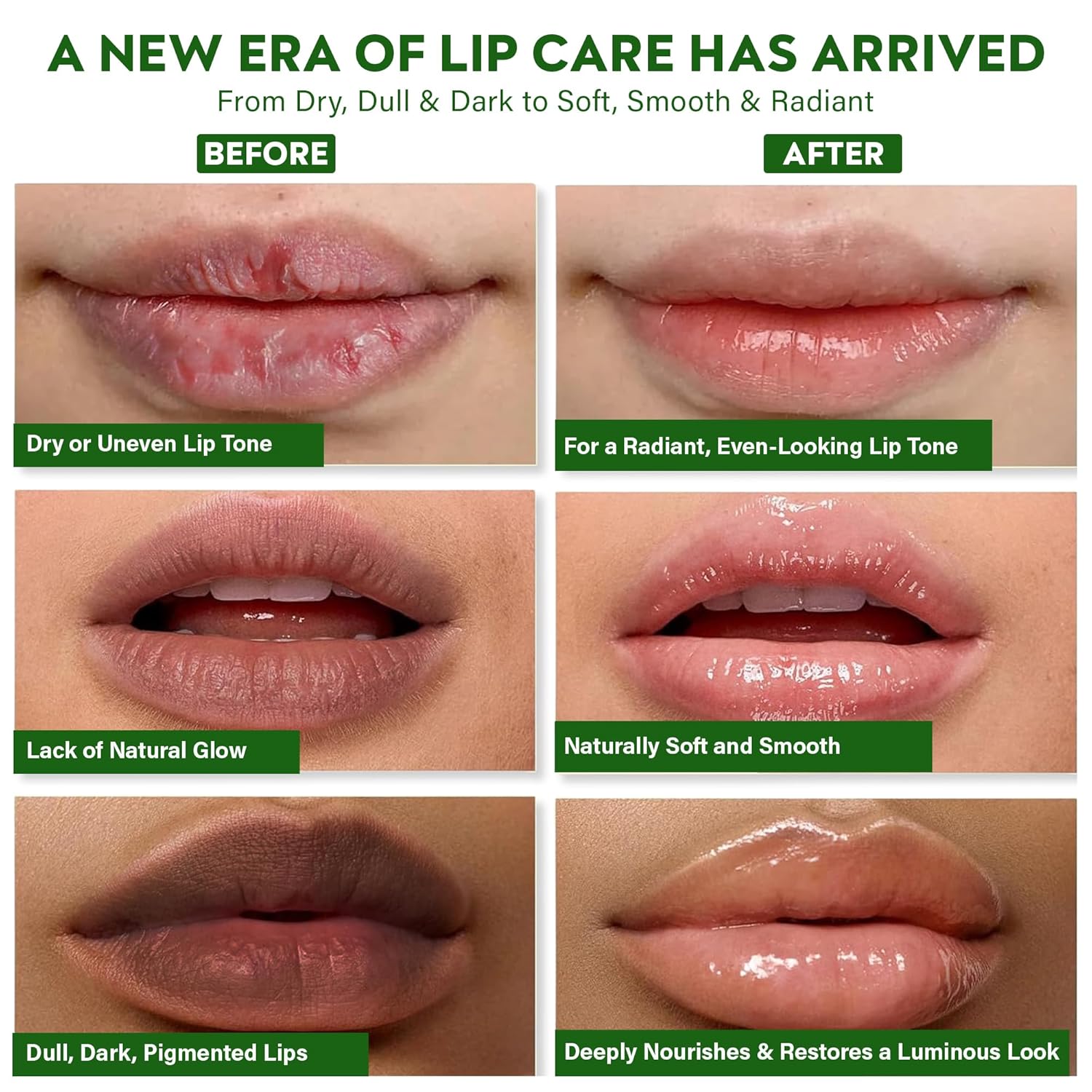 Vegan Lip Brightening Balm – Ayurvedic Lip Care for Dark & Smoker Lips | Deeply Hydrating, Moisturizing & Nourishing with Rich Antioxidants – Clean Beauty Plant-Based Formula