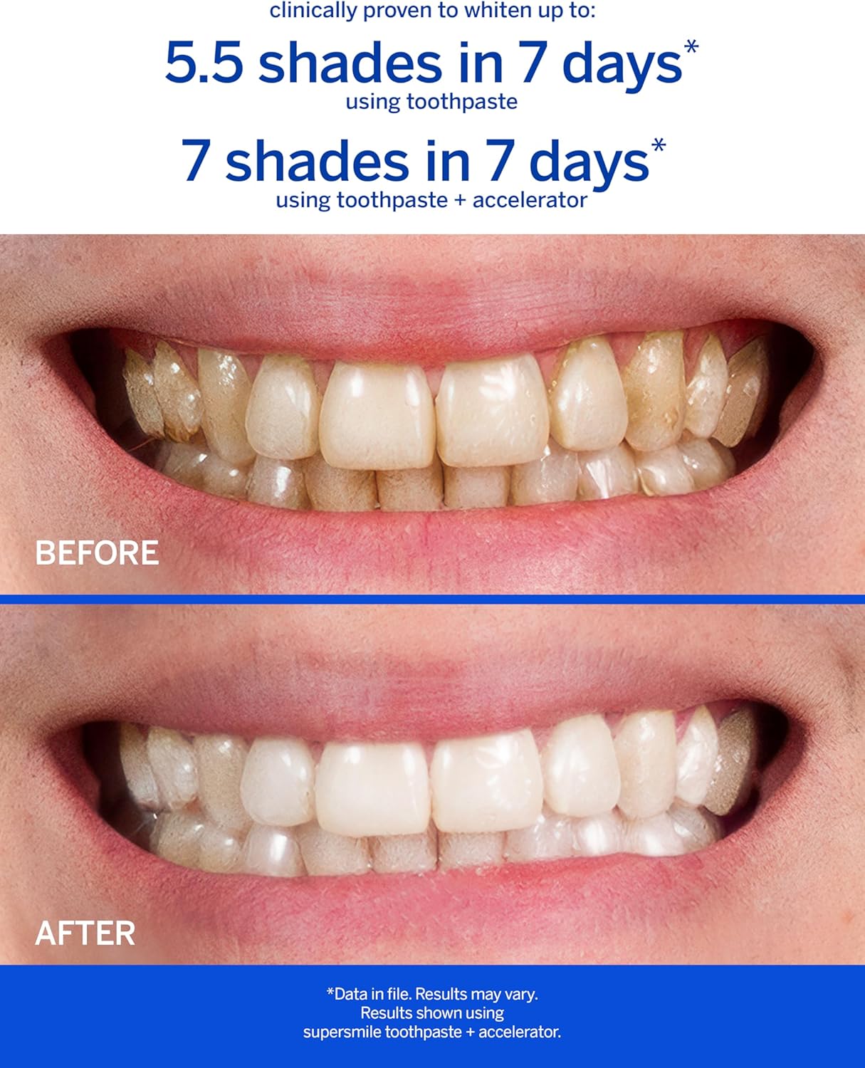 Supersmile Professional Whitening Toothpaste w/ Fluoride - Removes Stains & Whitens Teeth 6 Shades - Enamel Strengthening - No Sensitivity - Travel Size (Original Mint, 1.4 Oz)