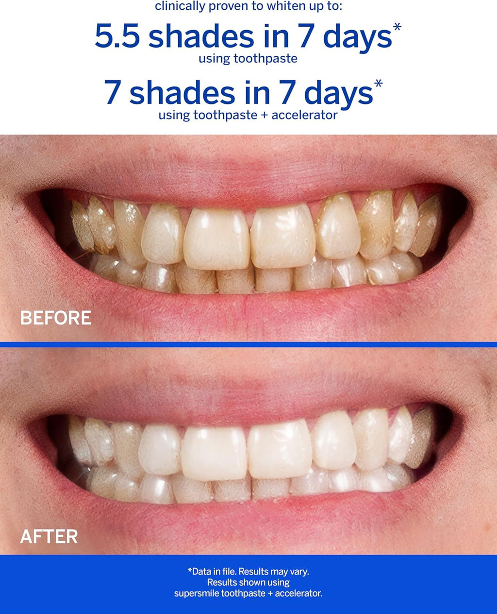 Supersmile Professional Whitening Toothpaste w/Fluoride - Removes Stains & Whitens Teeth 6 Shades - Enamel Strengthening - No Sensitivity - Travel Size (Original Mint, 1.4 Oz) (Pack of 2)