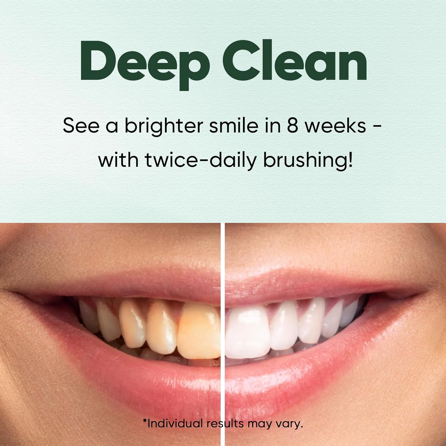 MySmile Fluoride Free Nano Hydroxyapatite Toothpaste for Sensitive Teeth, Strengthens Enamel, Remineralizes & Whitens Teeth, Freshens Breath for Adults, SLS Free, Natural Misty Mint, 4.2 oz, 2 Pack