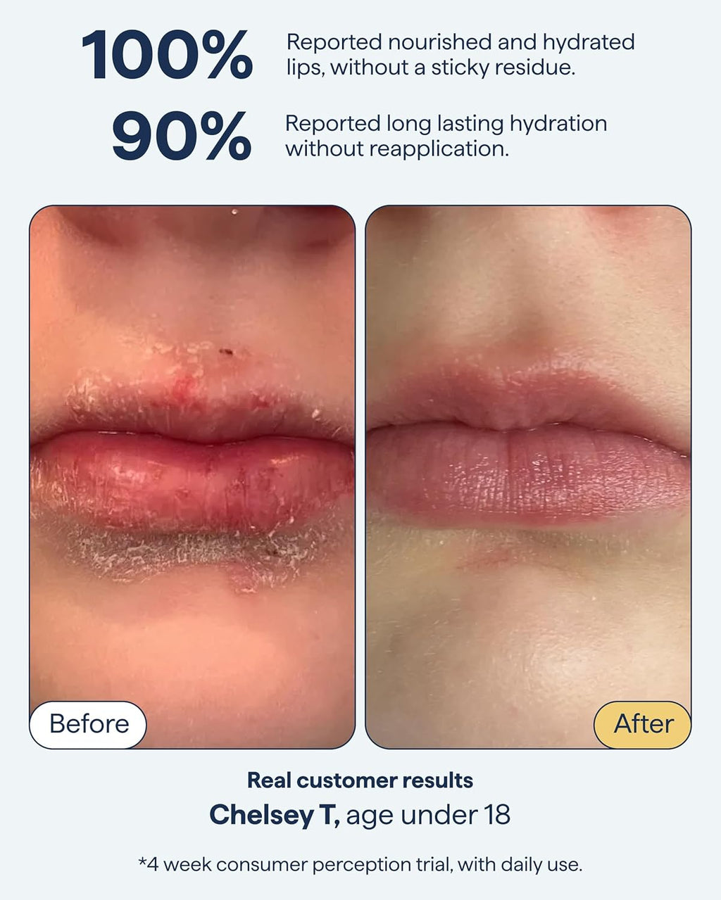 Remedy for Dry Lips - Hydrating and Healing Lip Balm Ointment with Ceramides, Peptides, and Dimethicone - Repairs Dry, Cracked Lips - By Dermatologist Dr. Shah
