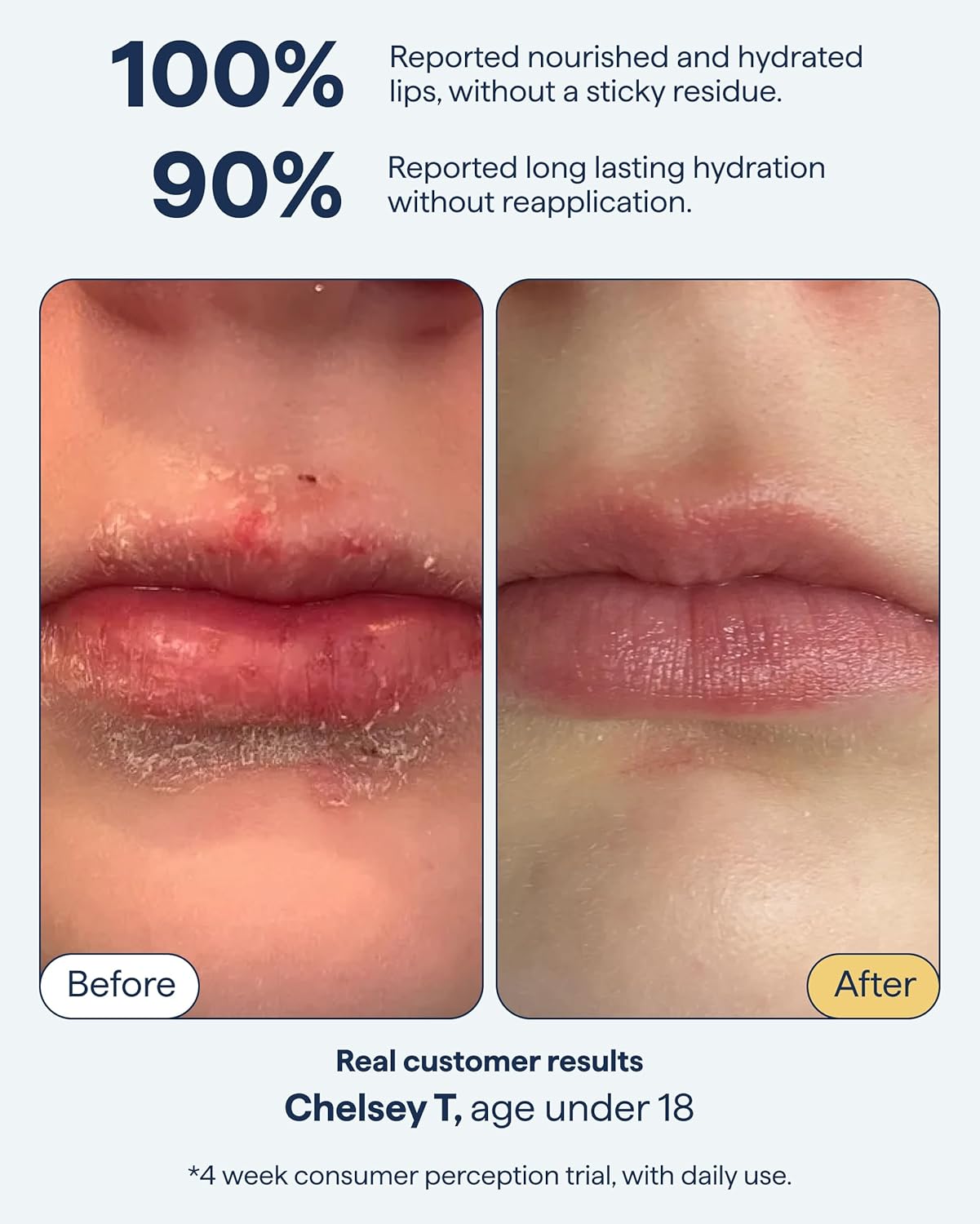 Remedy for Dry Lips - Hydrating and Healing Lip Balm Ointment with Ceramides, Peptides, and Dimethicone - Repairs Dry, Cracked Lips - By Dermatologist Dr. Shah