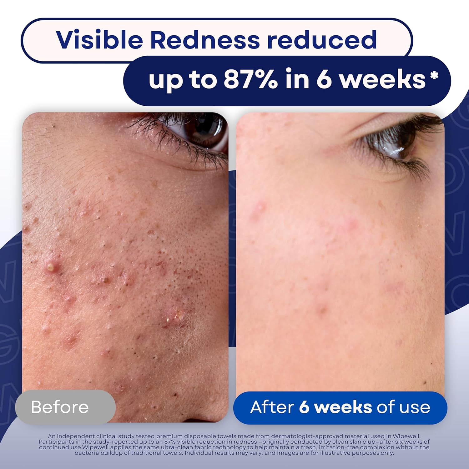 Disposable Face Towels, 50 Ct, 1 Pack, Ultra Soft Facial Dry Wipes, Multi-purpose for Skin Care, Dye-Free, Paraben-Free, Makeup Remover Clean Towel