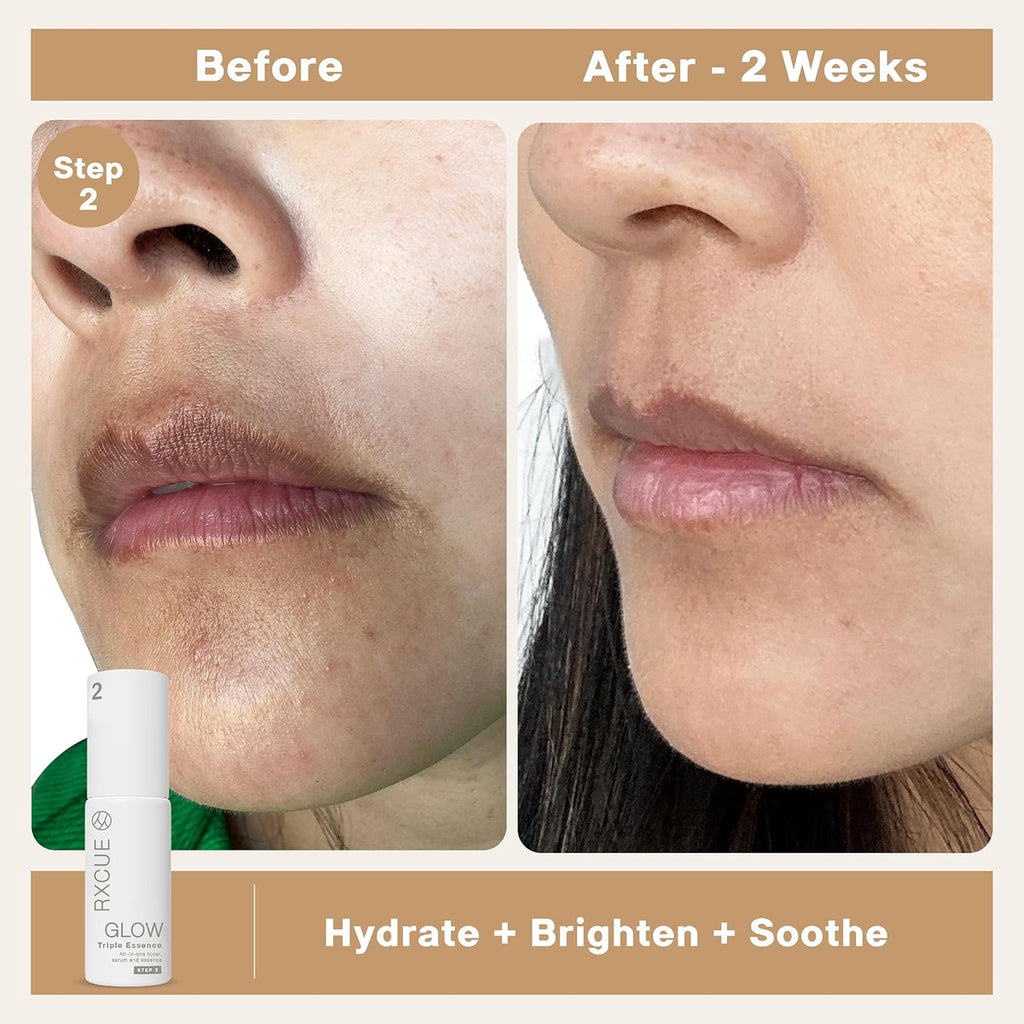 Travel Size Korean Skincare Set – Simplified 3-Step K-Beauty Kit, Rxcue Glow Patented 10-in-3 System for Glass Skin, TSA Approved, Korean Skin Care Travel Set, Skincare Kits & Gift Set, 1.01 fl oz ea