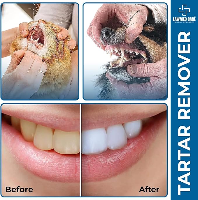 Plaque and Tartar Remover Stainless Steel Dental Tool Set - Dental Pick, Tooth Scraper - Professional Home Oral Care and Dentist Kit (Pack of 1)