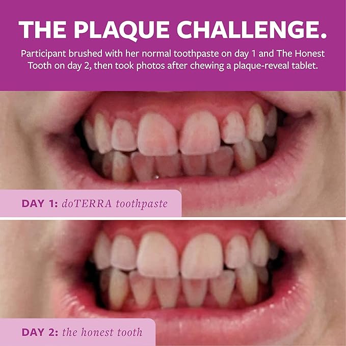 The Honest Tooth - Natural Tooth Cleaning Powder | Enamel-Friendly Baking Soda Formula | Whitens & Brightens Smile | SLS-Free, Plant-Based Oral Care, 2.8 oz