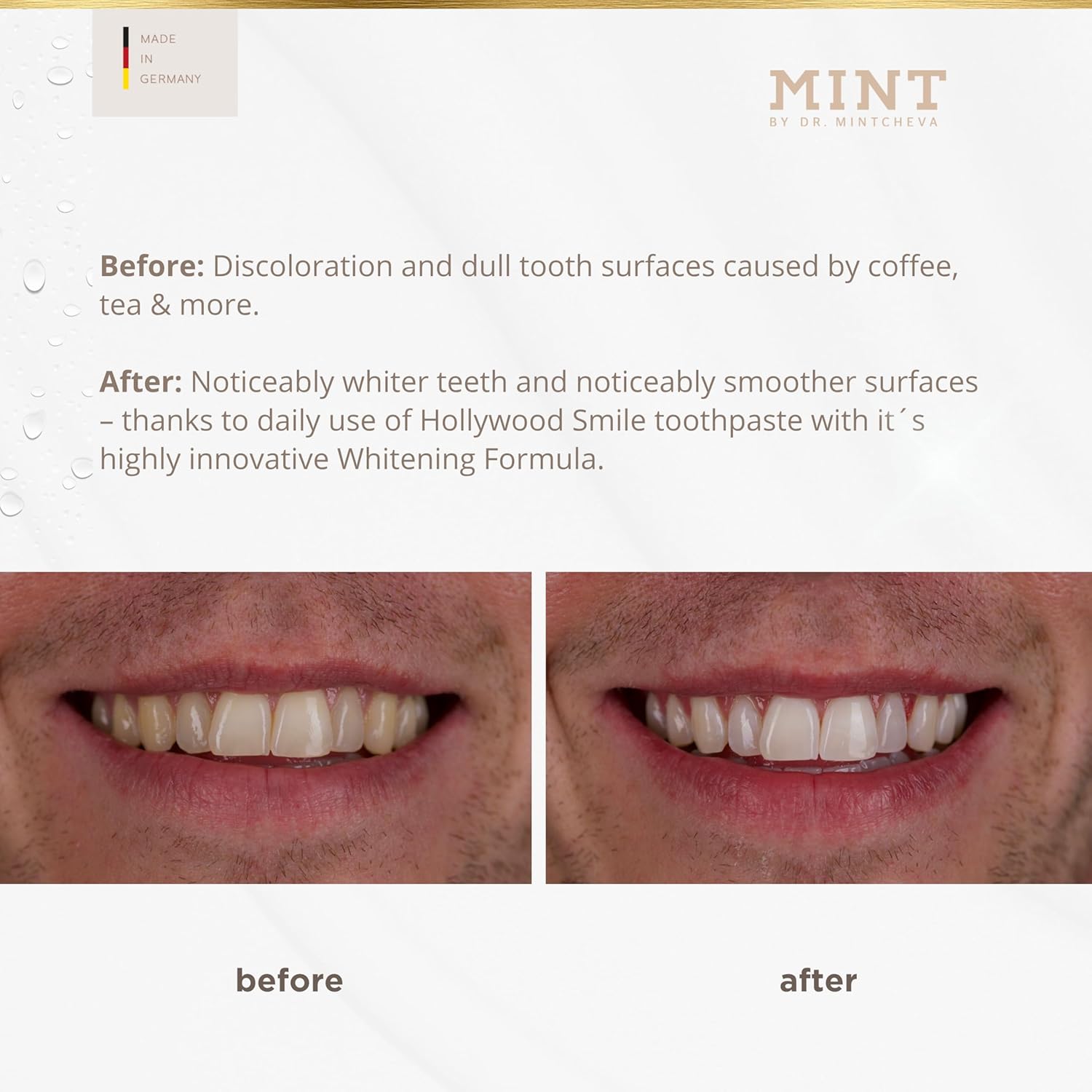 Mint Bright Smile Essential Set – Whitening Polishing Paste & Mouthwash – MPT1 Ultra Polish Technology with Perlite – Hydrogen Peroxide for Radiant Teeth – Vegan, Alcohol-Free, Microplastic-Free