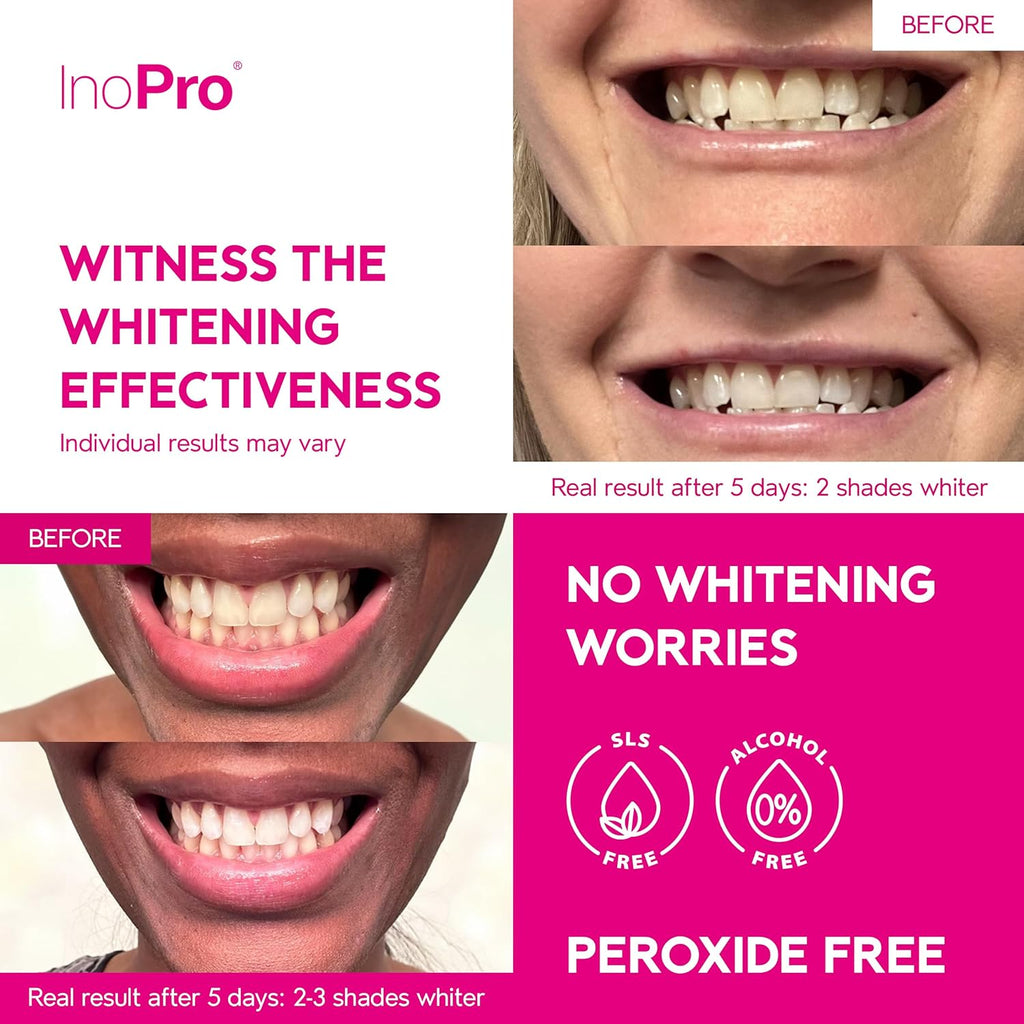 InoPro Teeth Whitening Strips 21 Treatments Kit - Teeth Whitener, Peroxide Free, Green White Strips for Teeth Whitening with Arbutin, Coconut Oil, Deep Stains Removal (42 Strips)