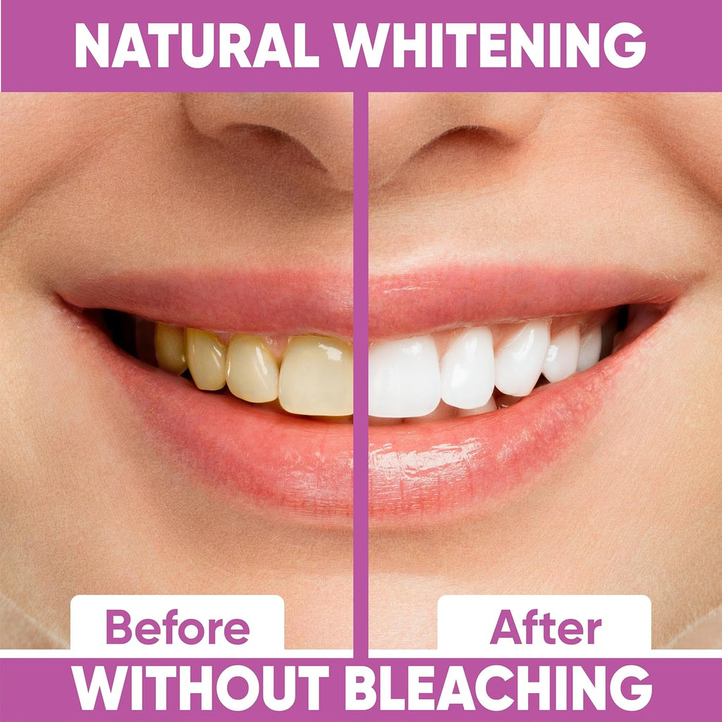 Gentle Teeth Whitening Strips - (28 Stripes) Bleaching Teeth Free of Peroxide for a Radiant Smile - Gentle Tooth whitening