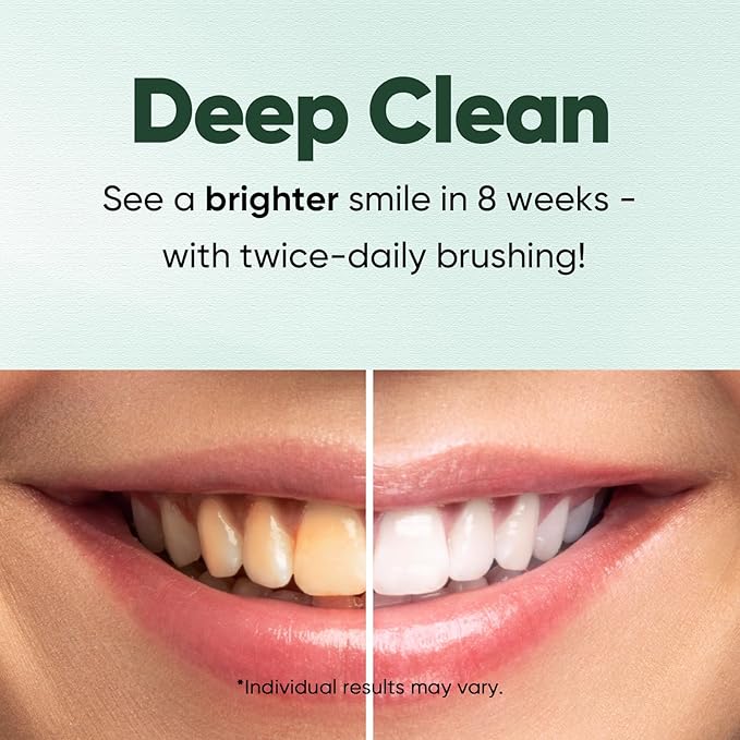 MySmile Fluoride Free Nano Hydroxyapatite Toothpaste for Sensitive Teeth, Strengthens Enamel, Remineralizes & Whitens Teeth, Freshens Breath for Adults, SLS Free, Misty Mint, 4.2 oz