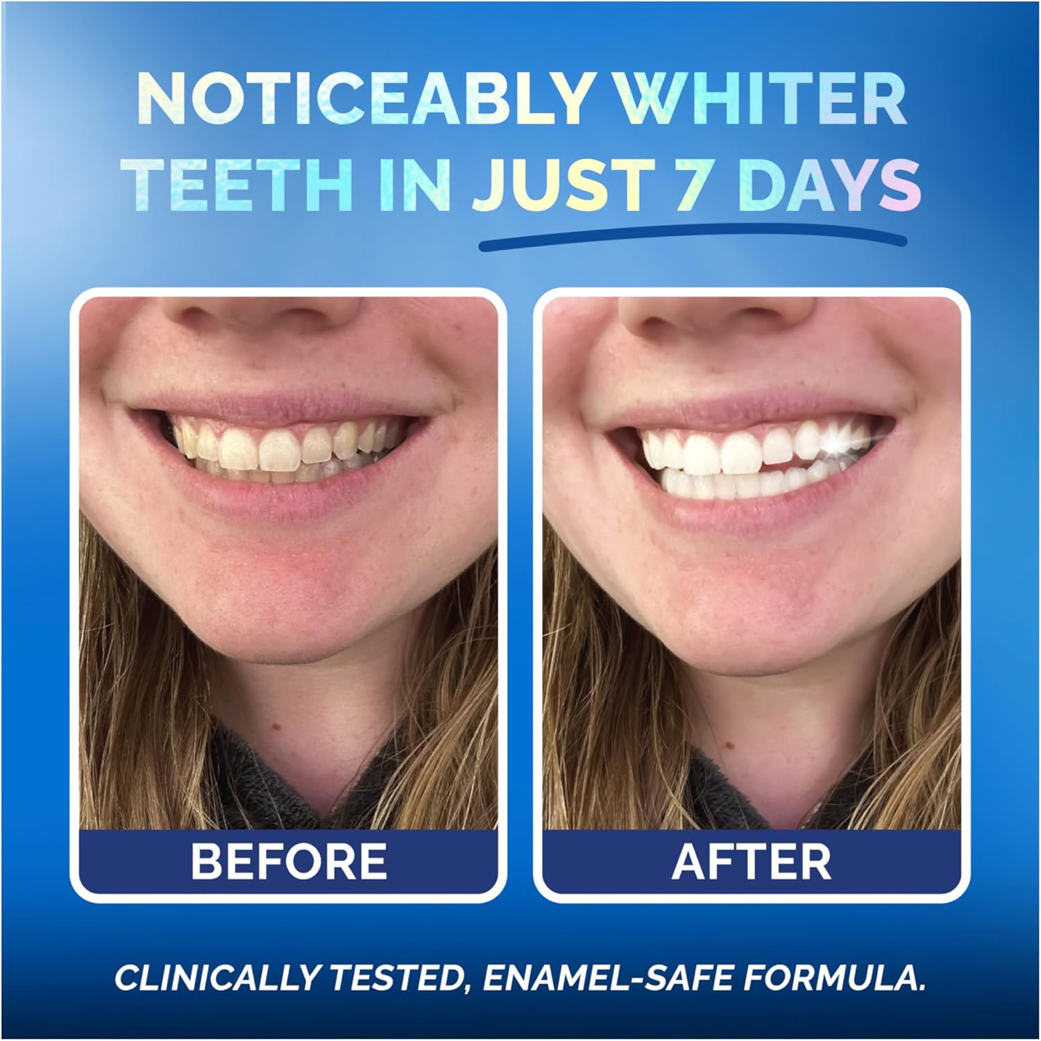 Whitening Strips for Sensitive Teeth 21 Treatments, Mint – Enamel Safe, Peroxide-Free Coconut Teeth Whitening Strips with Natural Enzymes – Gentle White Stips for Sensitive Gums & Daily Oral Care