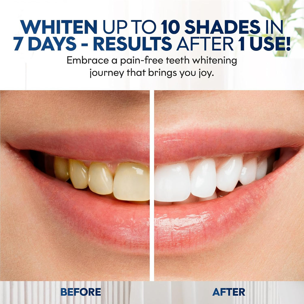 Chloe’C Teeth Whitening Strips | 7 Mint-Flavored Treatments for Sensitive Teeth | Non-Toxic Whitening Strips | Enamel Safe & Peroxide-Free | Removes Stains in 7 Days | Gentle-Effective Teeth Whitening