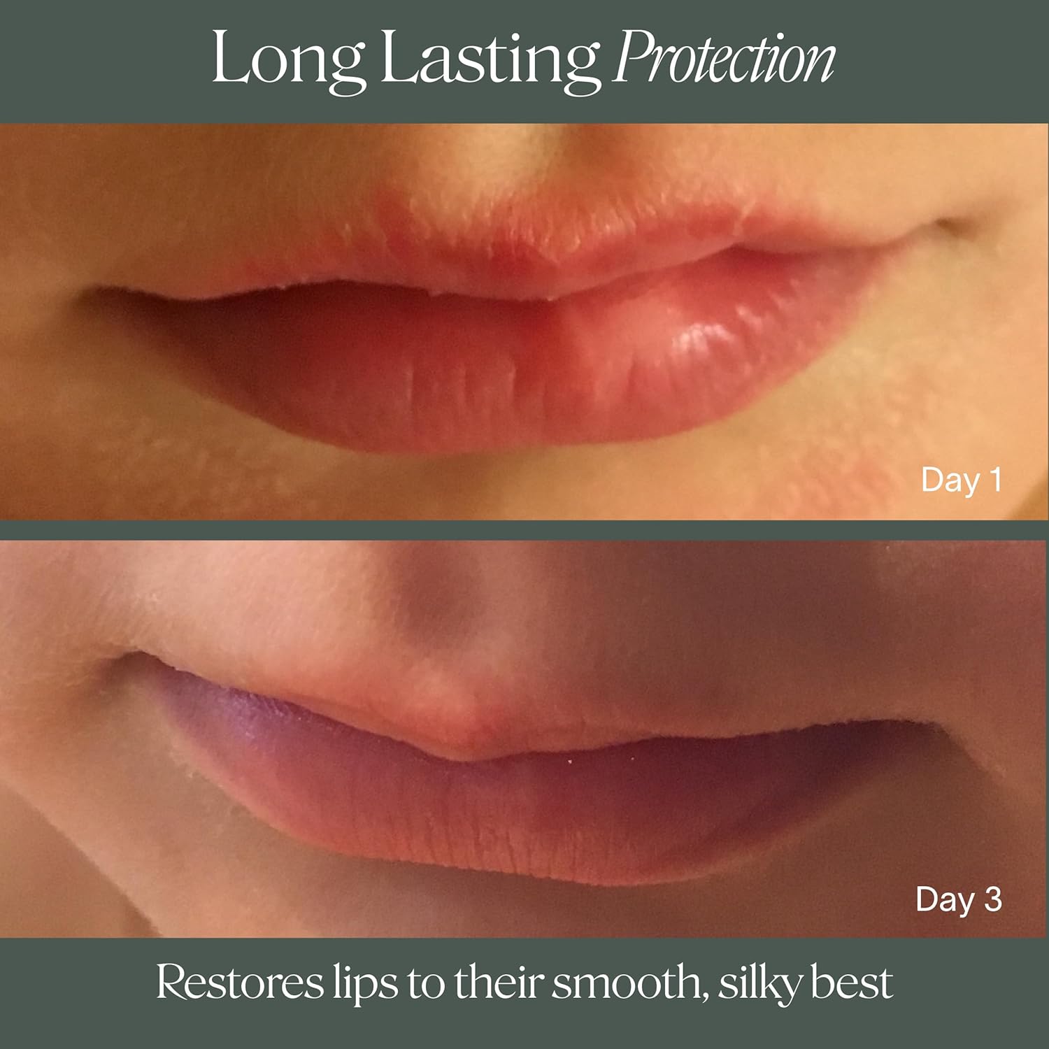 Doctor Rogers Lip Balm. Hydrating & Softening Lip Moisturizer for Very Dry Lips, Natural & Hypoallergenic, 0.15 Ounce (4.25 g), Pack of 3 tubes