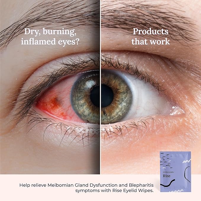 CorneaCare Rise: Eyelid Wipes | Eye Wipes for Dry Eyes | Eyelid Wipe with Tea Tree Oil & Hyaluronic Acid | Travel Ready | 30 Count